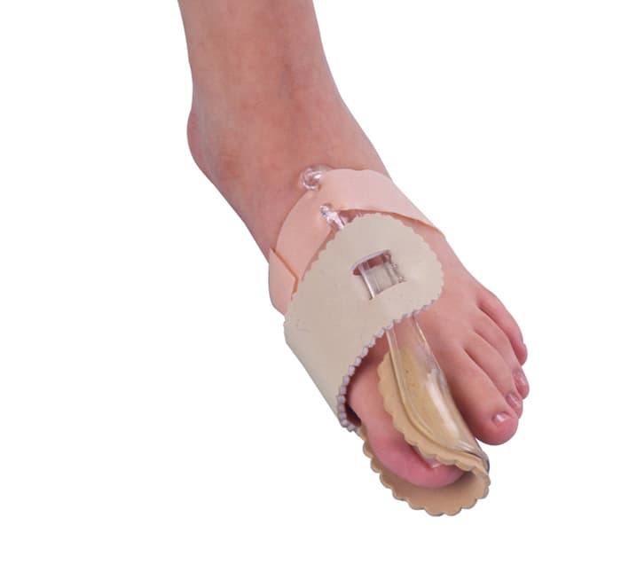 HALLUX VALGUS — vue 1