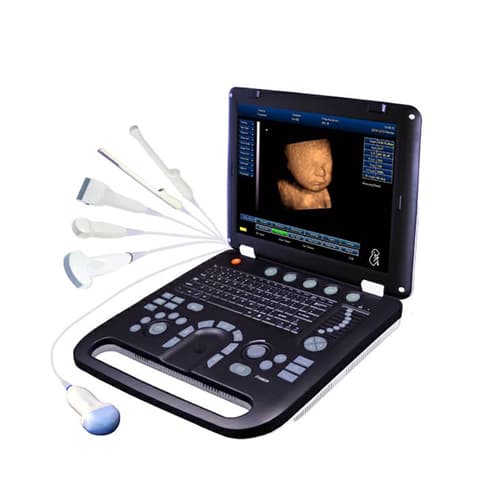 ECHOGRAPHE PORTABLE — vue 1