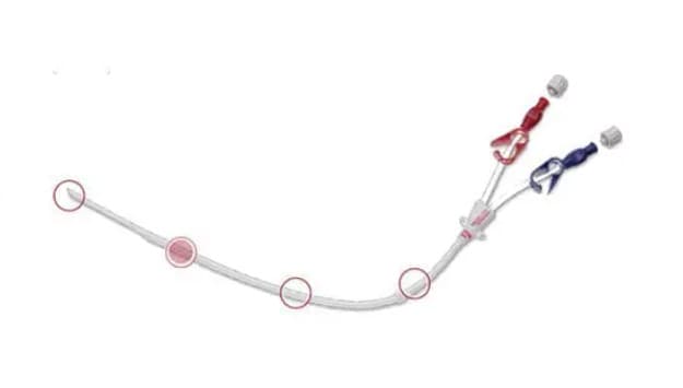 Cathéter Hémodialyse Double Lumière 12fr 20cm