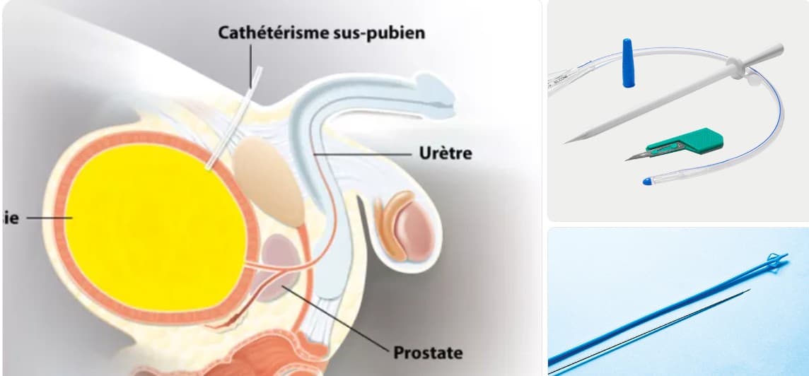 Set de drainage sus-pubien Cystodrain®