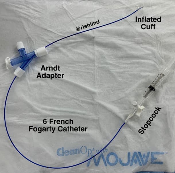 Cathéter d’embolectomie Fogarty
